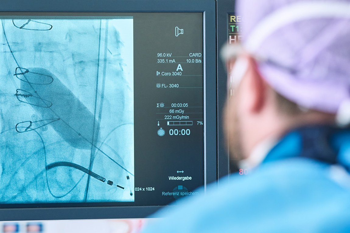 Augustinum Klinik Kardiologie und Intensivmedizin Ein Arzt betrachtet einen Scan auf einem Bildschirm