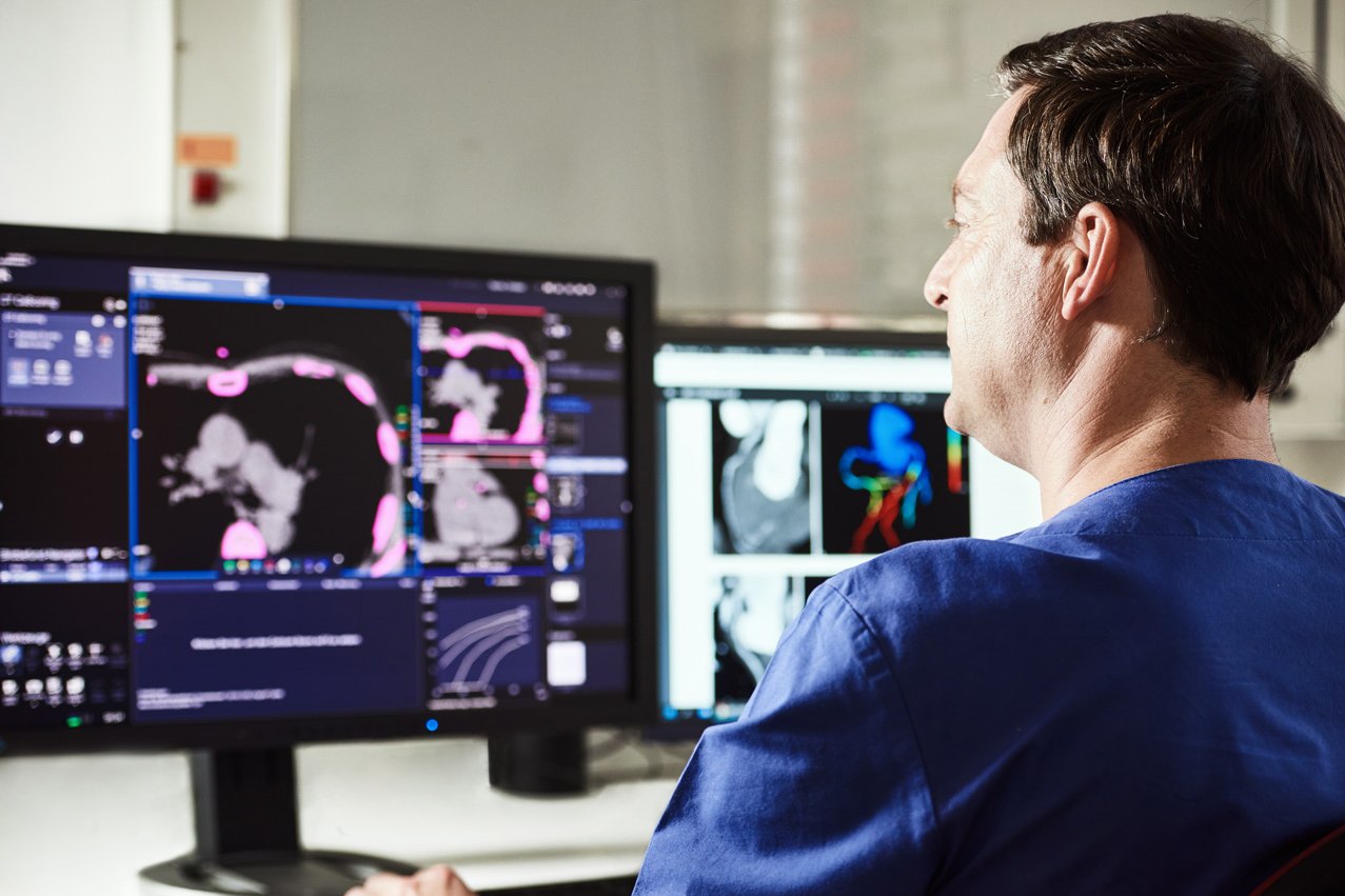 Kardiale Computertomographie Ein Arzt an einem Monitor begutachtet die Computertomographie eines Herzens